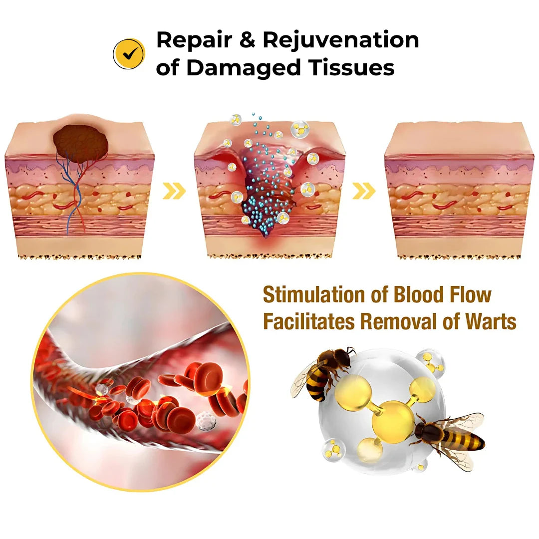 Skin Tag Remover Patch  (72 Patches)
