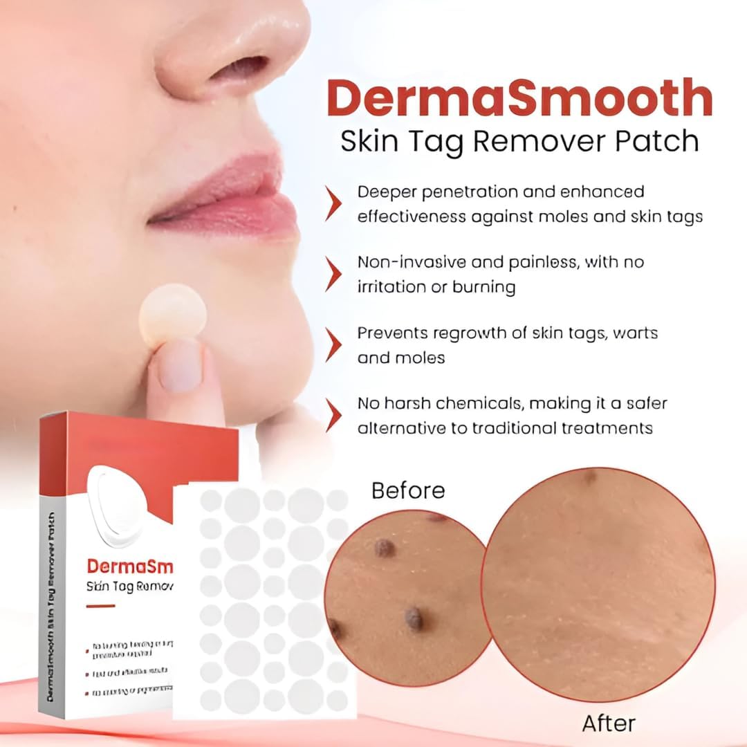 Skin Tag Remover Patch  (72 Patches)