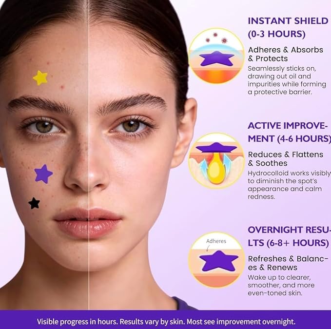 200 PCS Colorful Pimple Patches – Fast Healing Acne Spot Stickers
