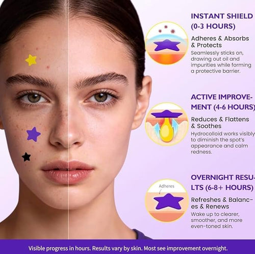 200 PCS Colorful Pimple Patches – Fast Healing Acne Spot Stickers