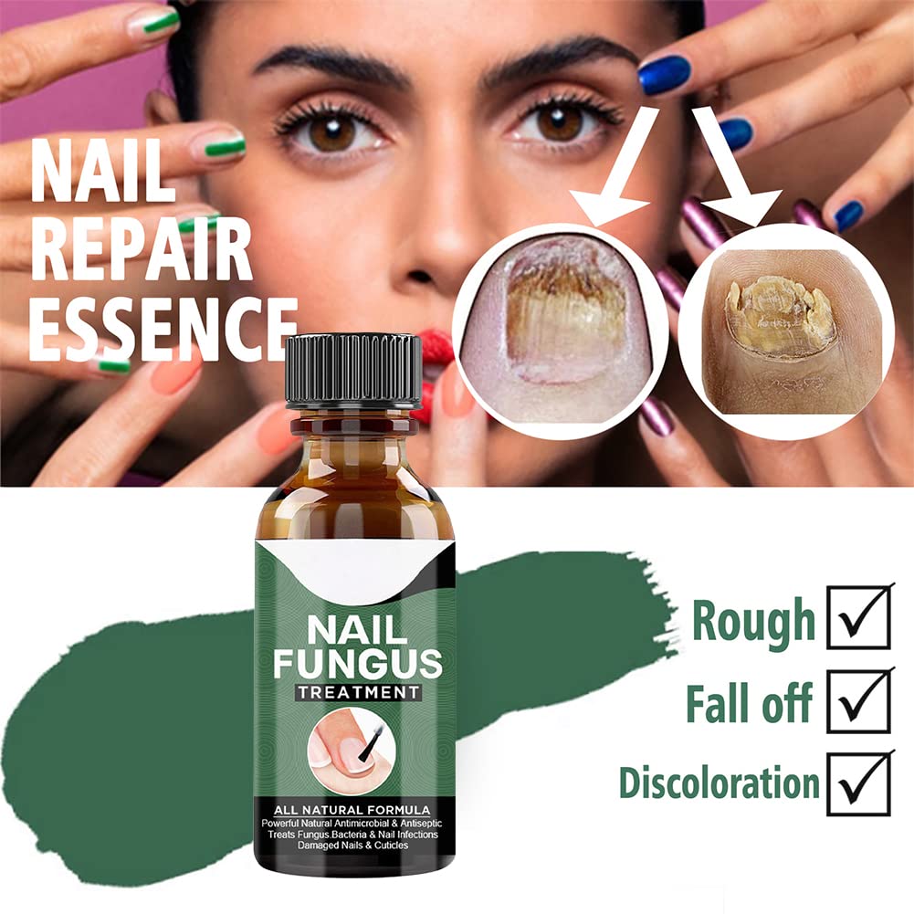 Nail Fungus Treatment Oil (Imported)