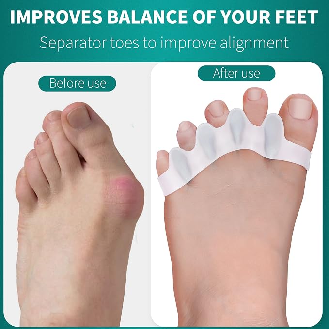 Premium Silicone Gel Toe Separators for Foot Alignment (Set of 2)