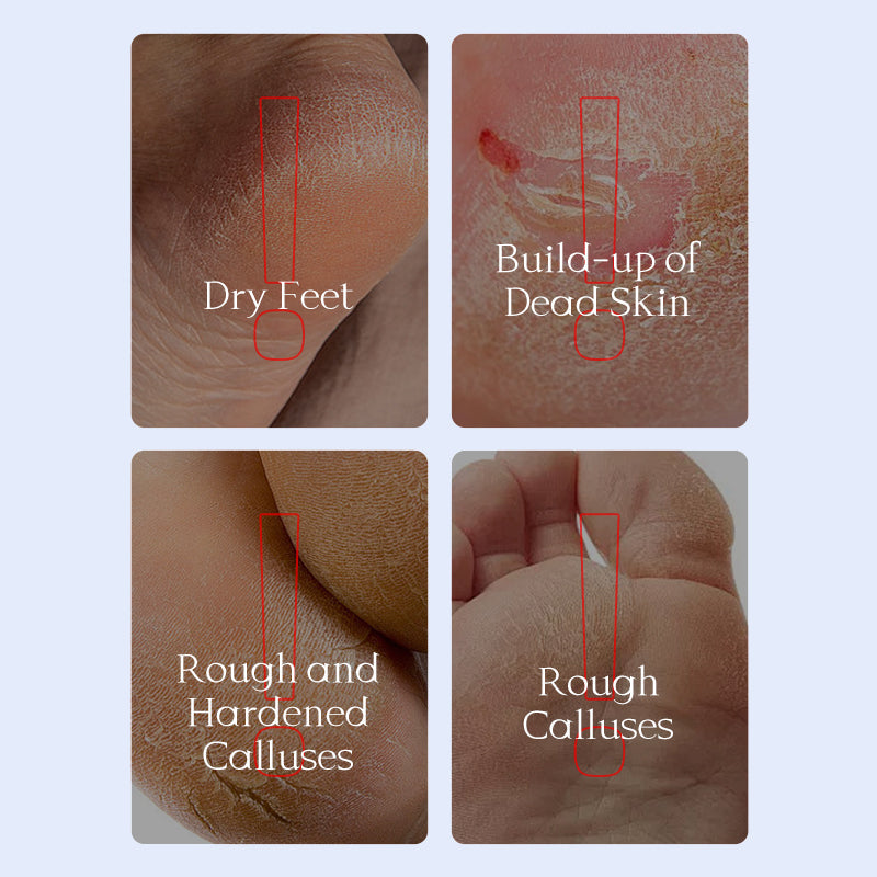PEEL OFF FOOT MASK (Pair) IMPORTED