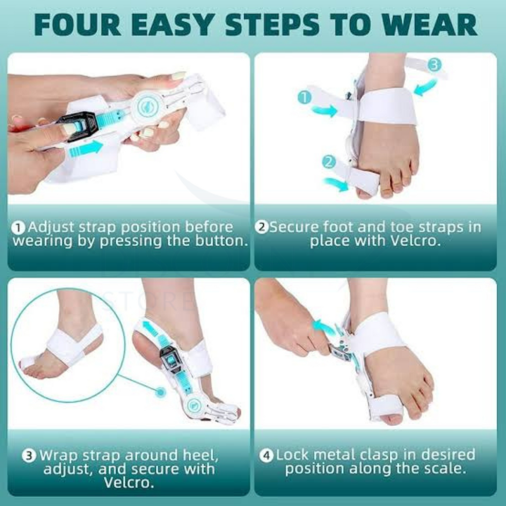Pain Relief Bunion Toe Corrector - (IMPORTED W/O KNOB)