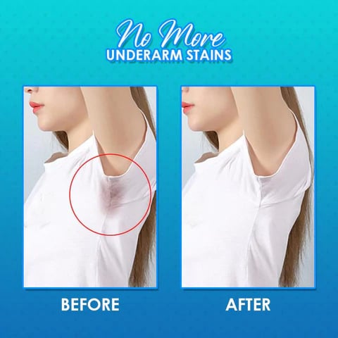 Underarm Sweat Pads (PACK OF 10)